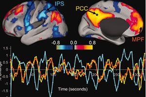 大脑，永不停工的机器